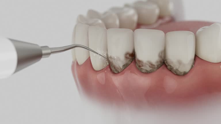 Reliable Dental contractor in Samson, AL by Smile Center Dentistry